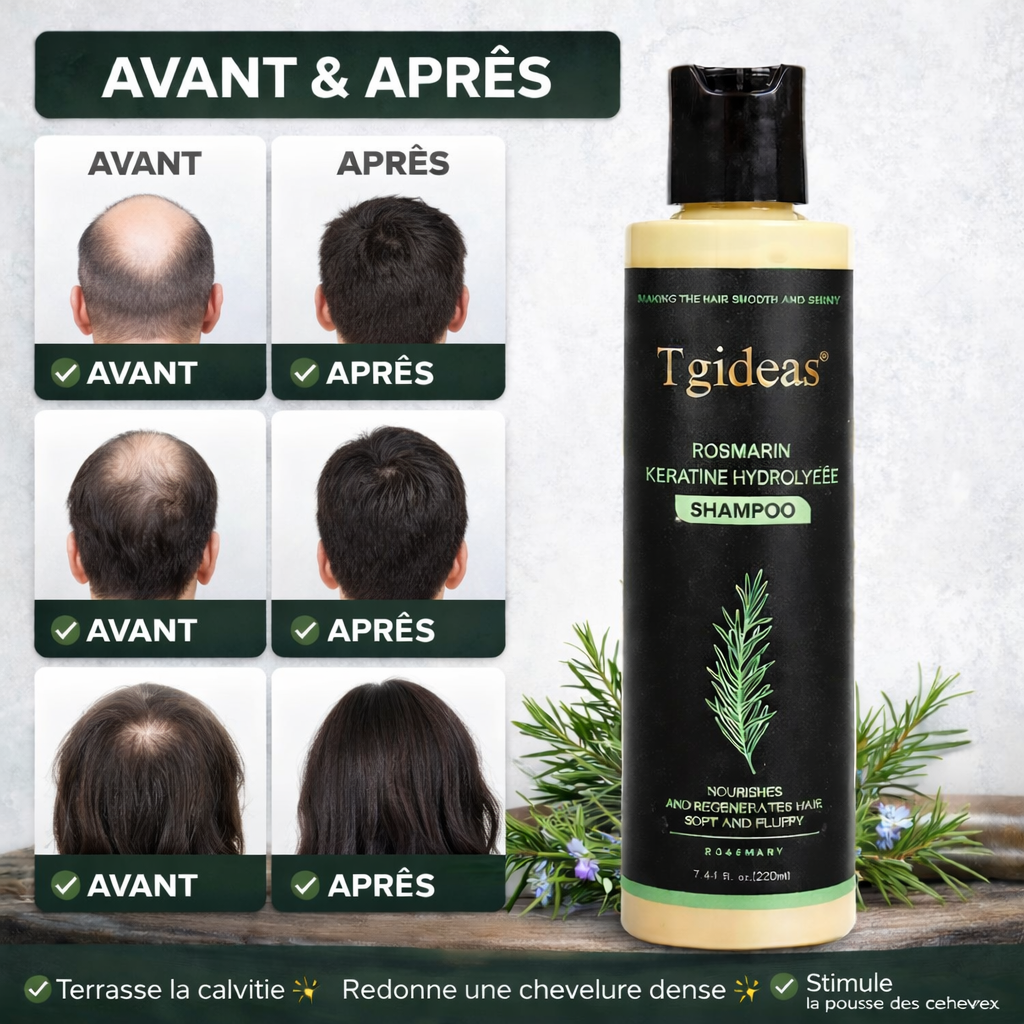 Tgideas® Romarin | Anti-Chute & Croissance Intense